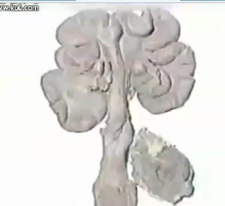 提高母猪繁殖率新技术